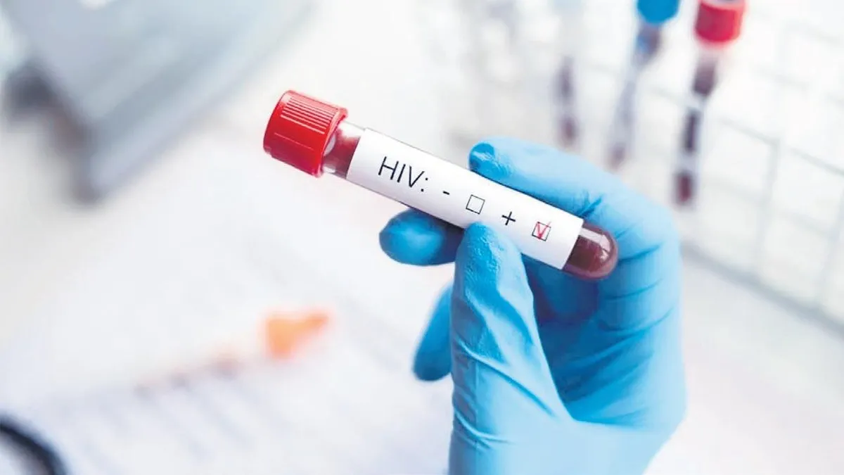 HIV pandemisi dakikada 1 kişi HIV’den ölüyor